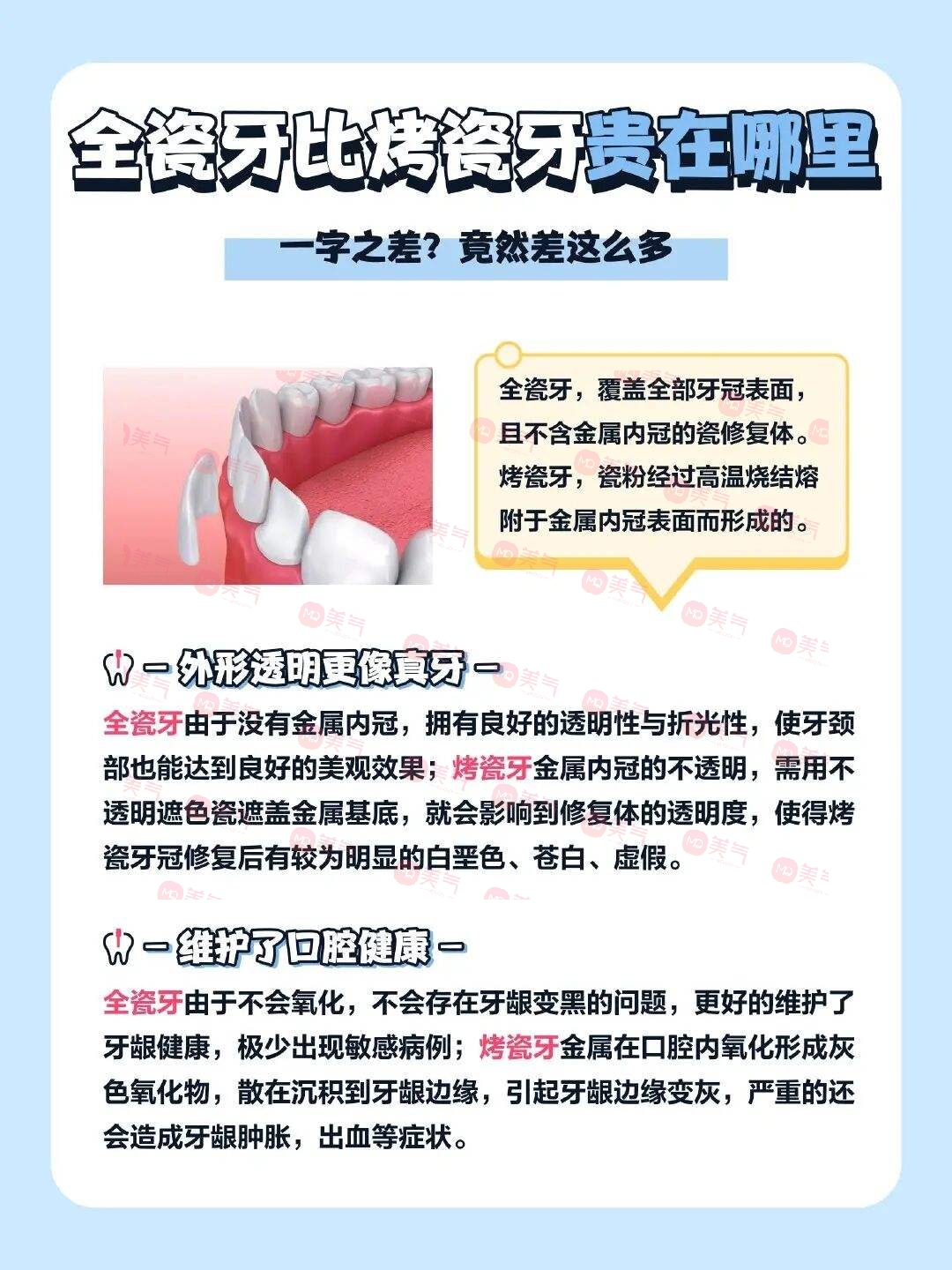 廣州全瓷牙價格多少？2023費用明細-全瓷牙優(yōu)勢、注意事項附上