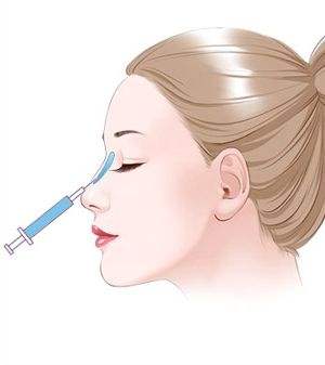 注射隆鼻要多少錢？項目介紹和優(yōu)缺點盤點