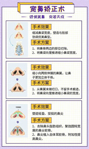 寬鼻梁矯正術(shù)真的有嗎?項(xiàng)目簡(jiǎn)介_(kāi)真實(shí)案例_優(yōu)缺點(diǎn)介紹