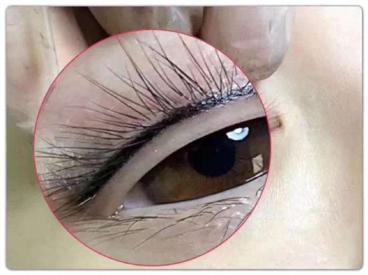 種睫毛要多少錢？效果怎么樣？簡(jiǎn)介和優(yōu)缺點(diǎn)盤點(diǎn)