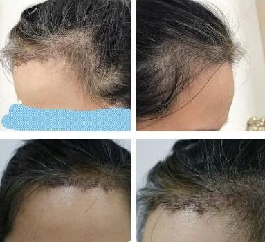 杭州格萊美醫(yī)療美容醫(yī)院怎么樣？