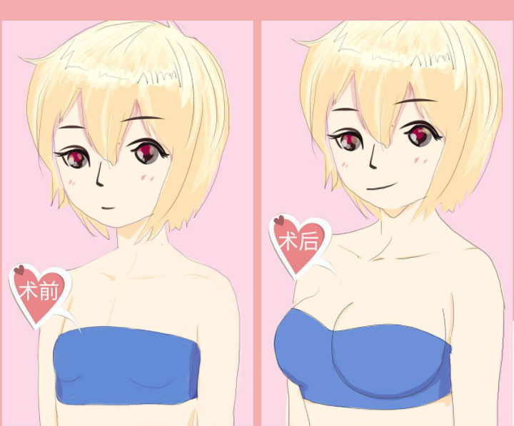 北醫(yī)三院美容整形科怎么樣？醫(yī)院信息＋案例分享