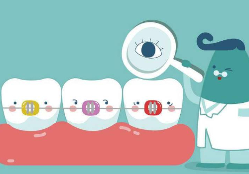 武漢協(xié)和醫(yī)院正畸多少錢？內(nèi)附正畸案例展示|牙齒矯正科普