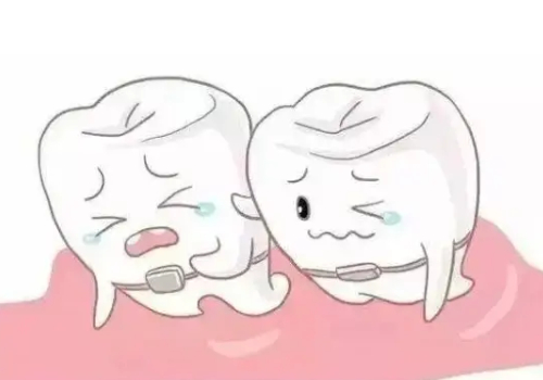 武漢協(xié)和醫(yī)院正畸多少錢？內(nèi)附正畸案例展示|牙齒矯正科普