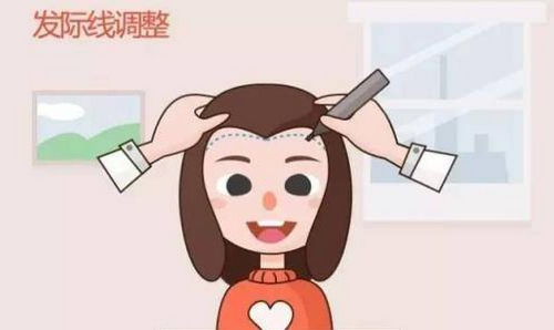 廣州青逸植發(fā)醫(yī)院靠譜嗎？醫(yī)生詳情及頭發(fā)種植案例