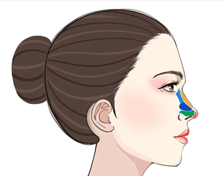 寧波薇琳整形醫(yī)院靠譜嗎？假體隆鼻案例口碑+收費(fèi)標(biāo)準(zhǔn)