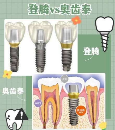 種植牙哪一種品牌最好？介紹10個(gè)比較有名的品牌
