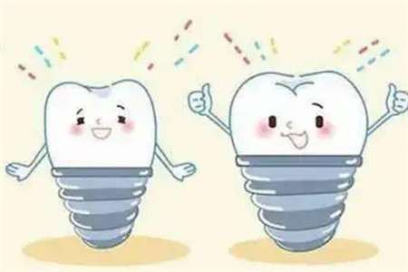 了解2024年種牙價(jià)格！一顆牙齒種植所需費(fèi)用大揭秘！