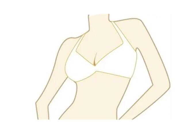 隆胸圖.jpg 隆胸圖.jpg