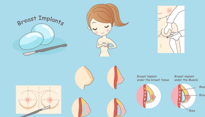 隆胸假體.jpg 隆胸假體.jpg