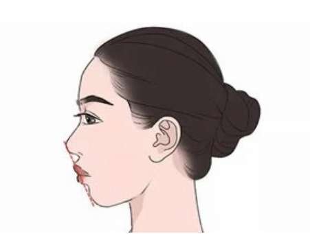 重慶王濤做的正頜怎么樣？在頜面外科擔(dān)任的主任醫(yī)生