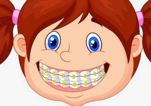 深圳種植牙多少錢(qián)一顆2024？一般是3800元起，不同的種植體產(chǎn)生不同的價(jià)格，所以只供參考