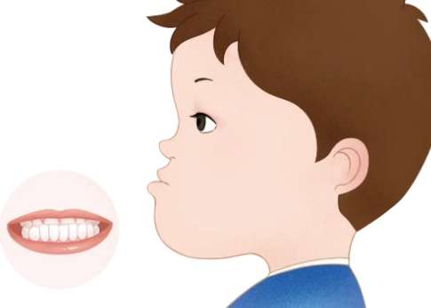 牙齒地包天怎么辦？可以采取的措施比較多，比如佩戴矯正器