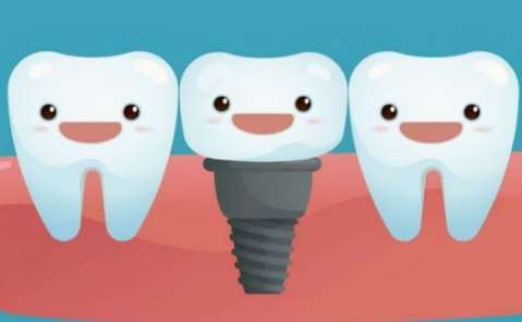dio種植牙價(jià)格多少錢一顆？以高品質(zhì)，合適的價(jià)格以及使用壽命而得到了很多求美者的稱贊