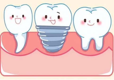 廈門種植牙多少錢一顆2024年？半口牙種植49396-141025元，單顆牙種植14332-25763元