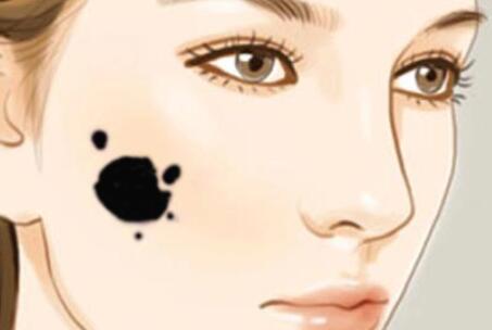 祛痣動(dòng)漫09.jpg