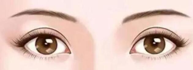 雙眼皮動(dòng)漫30.jpg 雙眼皮動(dòng)漫30.jpg