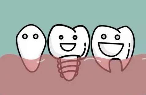 安徽種植牙多少錢？大概是從5000元到3萬元，所以價格并不固定