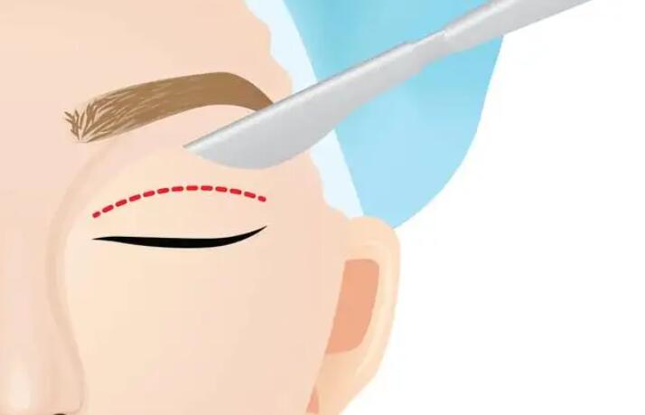 雙眼皮動漫55.jpg 雙眼皮動漫55.jpg