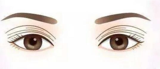 雙眼皮動(dòng)漫14.jpg