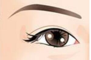 l雙眼皮i1.jpg l雙眼皮i1.jpg