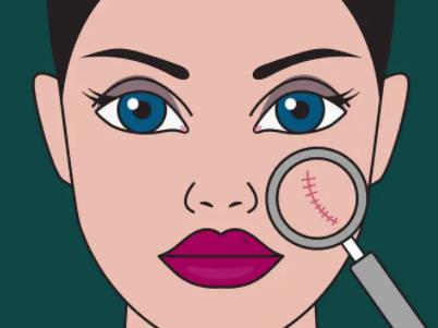 疤痕額頭dm03.jpg 疤痕額頭dm03.jpg