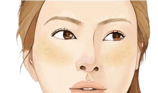 祛斑動(dòng)漫h4.jpg