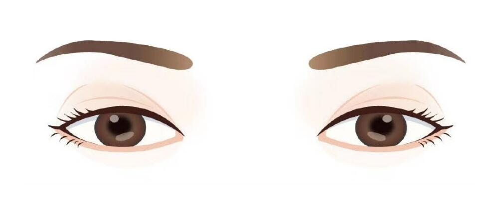 l雙眼皮i2.jpg l雙眼皮i2.jpg