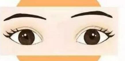 l雙眼皮y02.jpg l雙眼皮y02.jpg