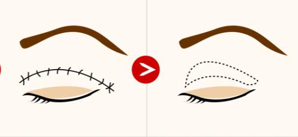 雙眼皮動(dòng)漫44.jpg 雙眼皮動(dòng)漫44.jpg