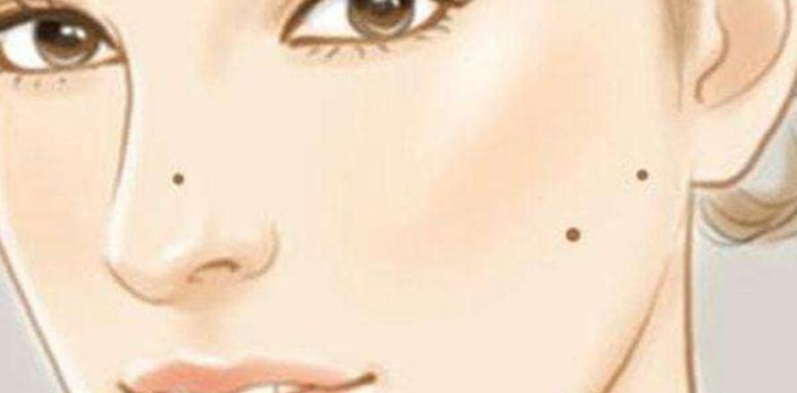 l祛痣q01.jpg l祛痣q01.jpg