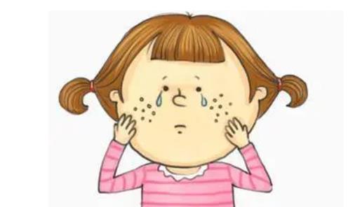 祛痘印01.jpg 祛痘印01.jpg