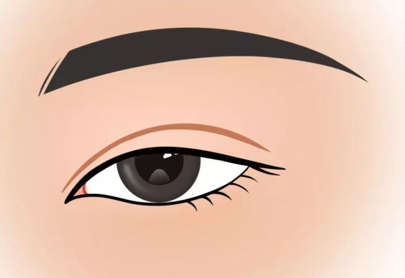 雙眼皮動漫06.jpg 雙眼皮動漫06.jpg