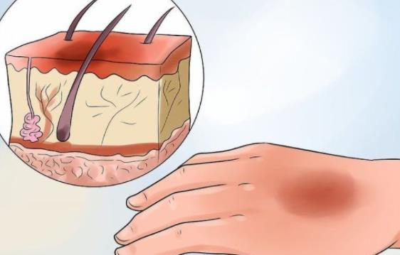 疤痕修復(fù)動漫01.jpg 疤痕修復(fù)動漫01.jpg