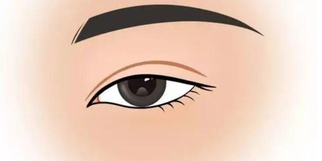 l雙眼皮q0.jpg l雙眼皮q0.jpg