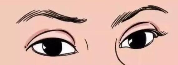 雙眼皮動(dòng)漫22.jpg 雙眼皮動(dòng)漫22.jpg