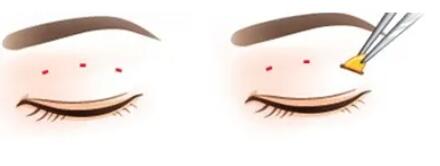 雙眼皮動漫58.jpg 雙眼皮動漫58.jpg