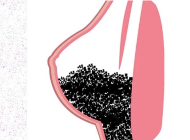 取奧美定01.jpg 取奧美定01.jpg