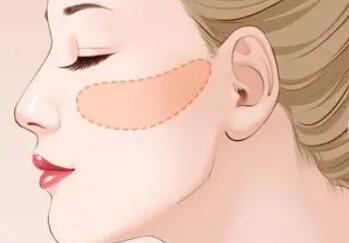 顴骨磨骨動(dòng)漫02.jpg 顴骨磨骨動(dòng)漫02.jpg