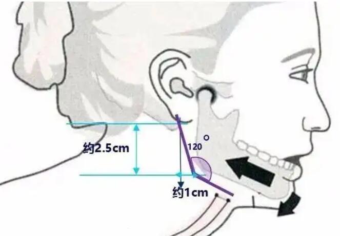 下頜角動漫20.jpg