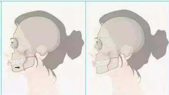 正頜動(dòng)漫01.jpg 正頜動(dòng)漫01.jpg