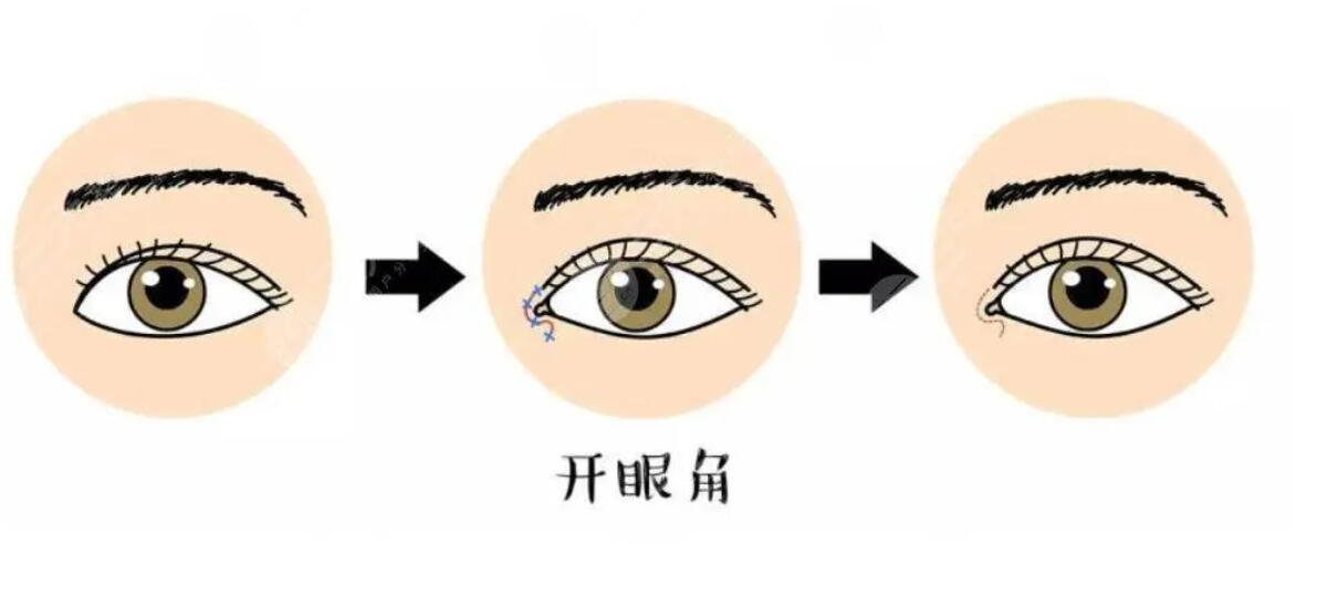 開眼角動漫.jpg