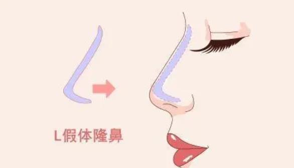 lbdm012.jpg lbdm012.jpg