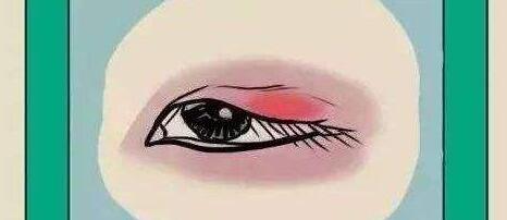 雙眼皮動漫34.jpg 雙眼皮動漫34.jpg