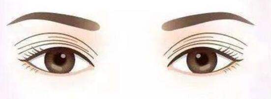 雙眼皮動漫31.jpg