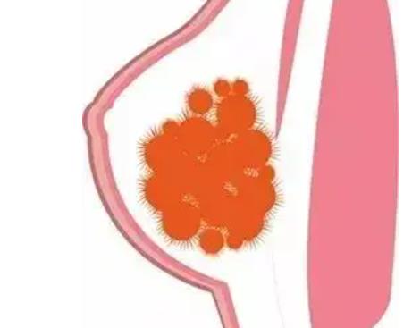 取奧美定05.jpg 取奧美定05.jpg