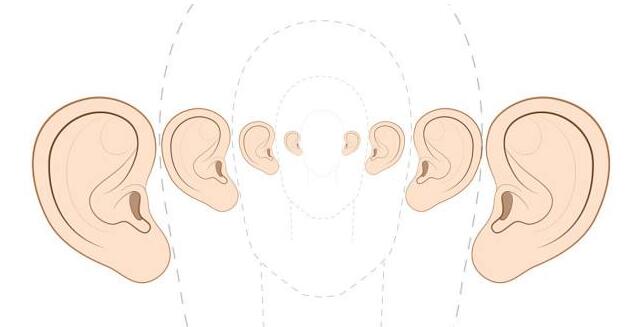 耳再造動(dòng)漫04.jpg 耳再造動(dòng)漫04.jpg