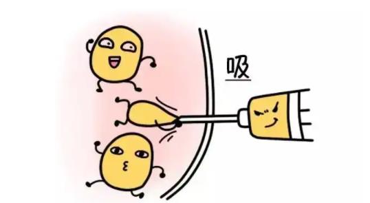 面部吸脂dm03.jpg 面部吸脂dm03.jpg