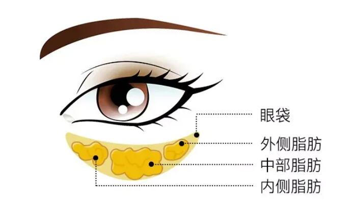 去眼袋動(dòng)漫24.jpg 去眼袋動(dòng)漫24.jpg