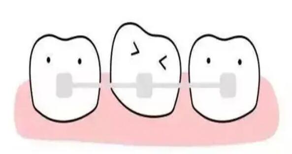 牙齒矯正動漫61.jpg 牙齒矯正動漫61.jpg